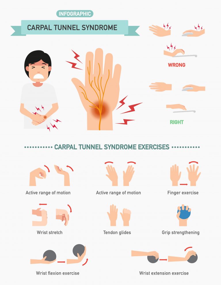 Carpal tunnel syndrome - causes, symptoms and treatment